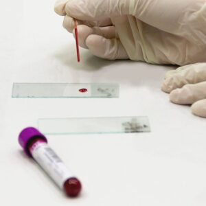 Consulta Online com Imunologista