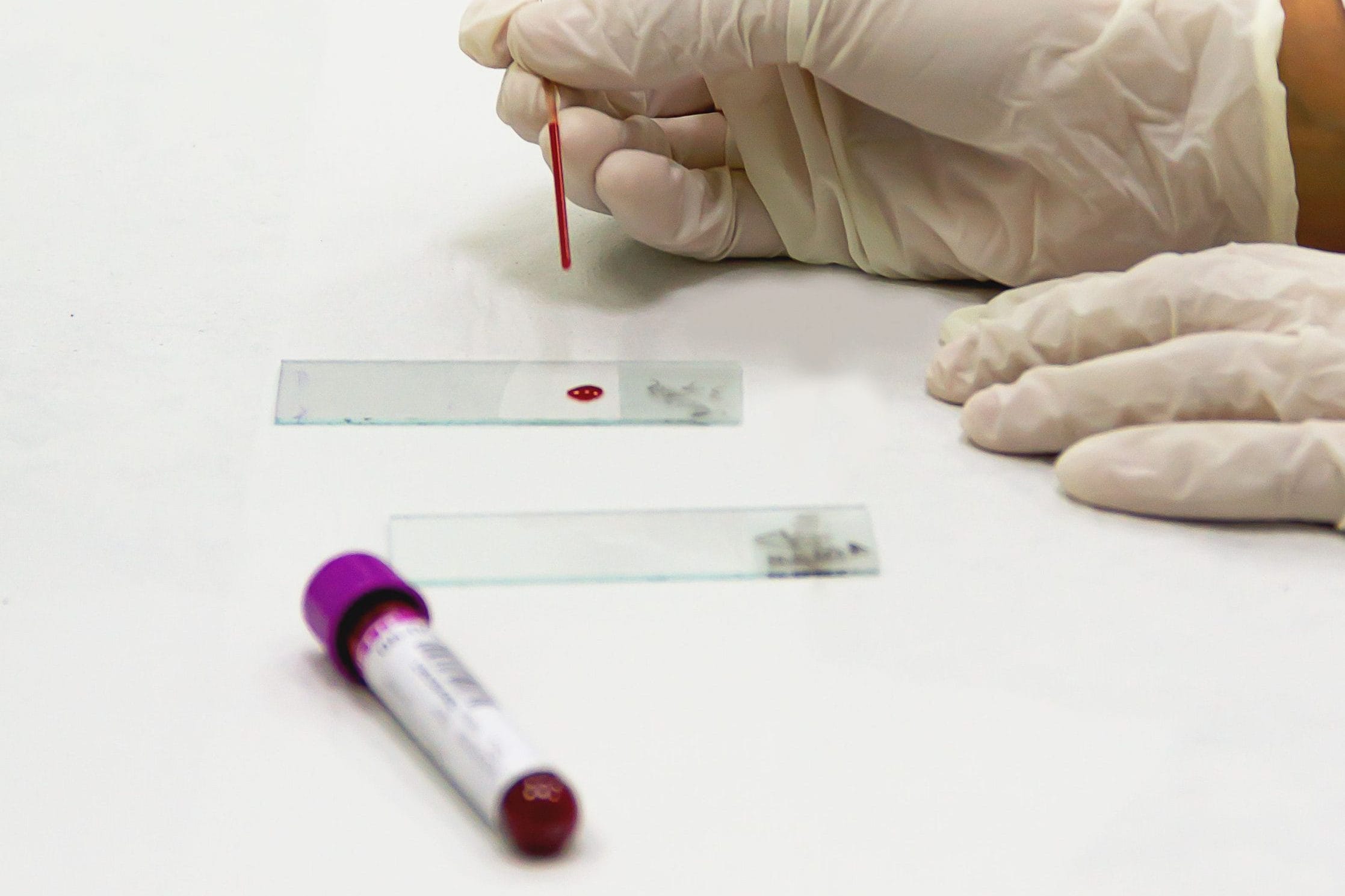 Consulta Online com Imunologista