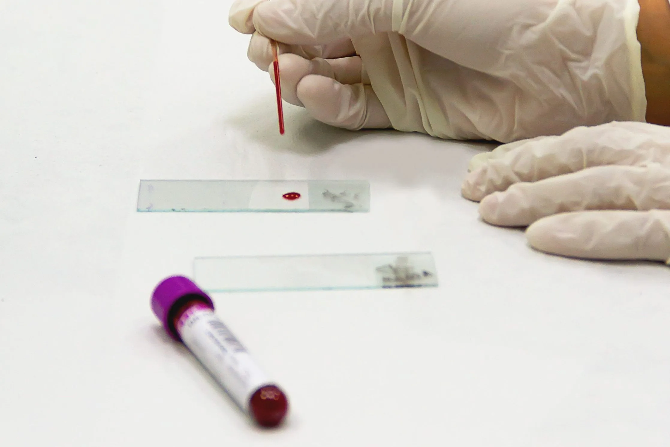 Consulta Online com Imunologista