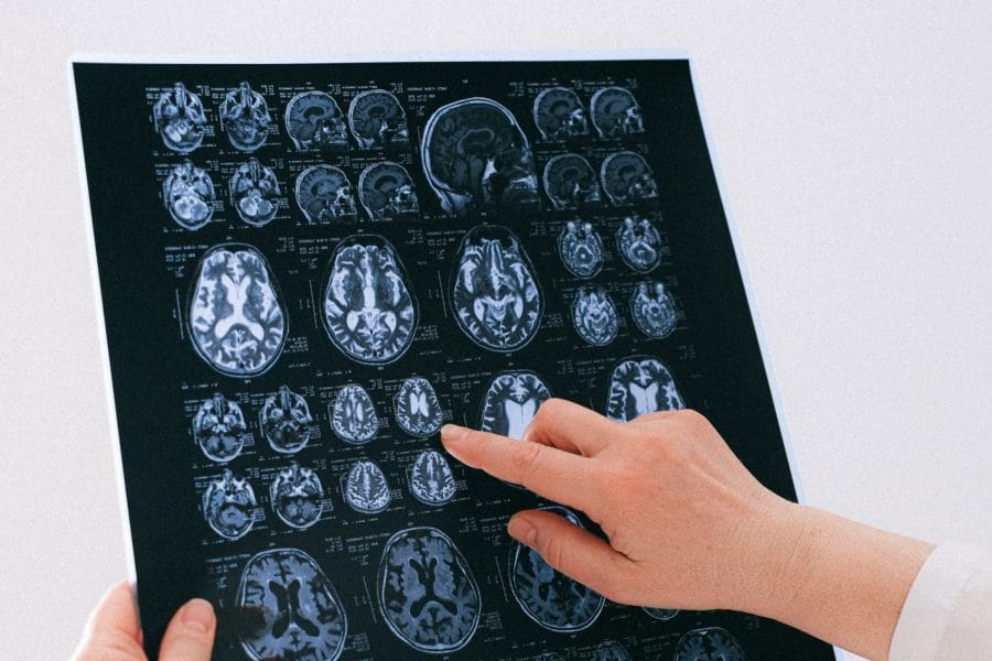 Consultas Online de Neurologia