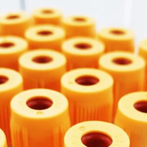 Tubos de ensaio para exames laboratoriais de Nutrologia