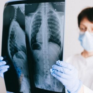 Médico examinando radiografia de pulmão