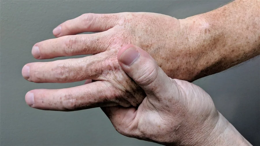 Consulta Online com Reumatologista: Dores Crônicas e Articulações
