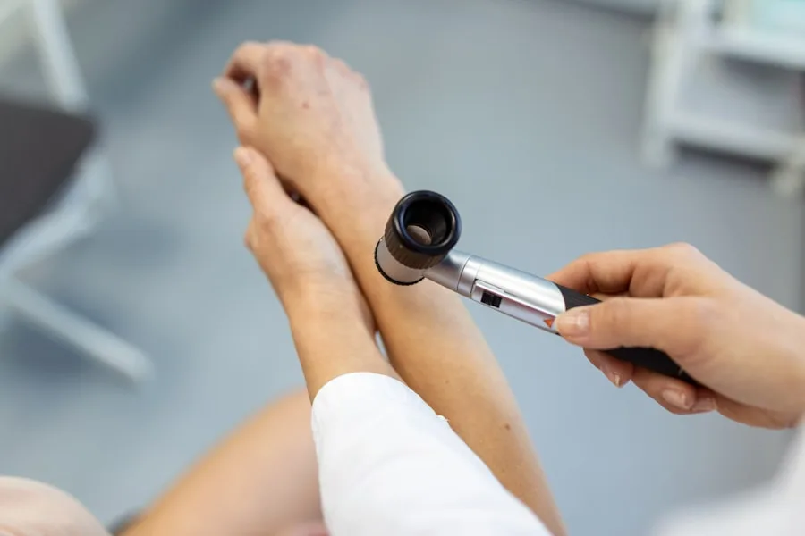 Dermatologista Online: Como Funciona a Consulta e Quando Procurar